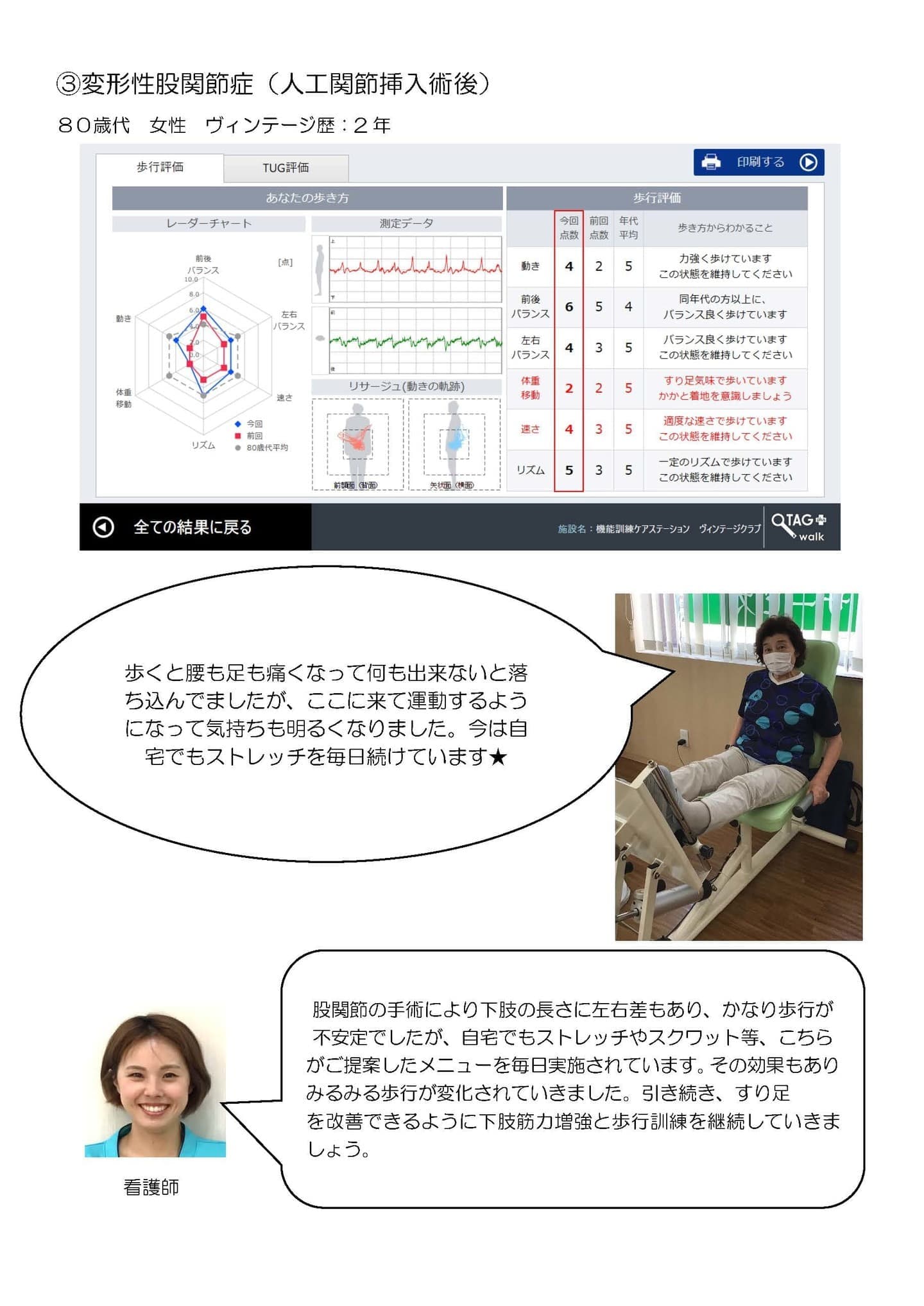 ③変形性股関節症(人工関節挿入術後)